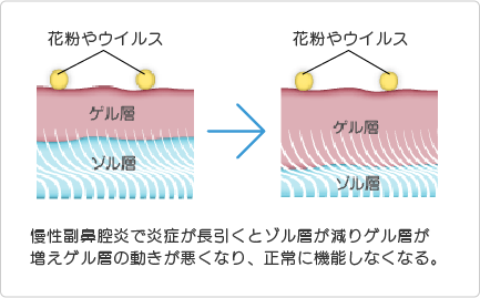 線毛運動の障害がおこるイメージイラスト