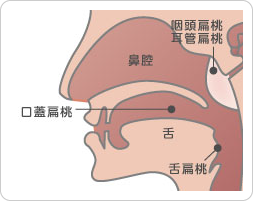 ４種類の「扁桃」を示した図